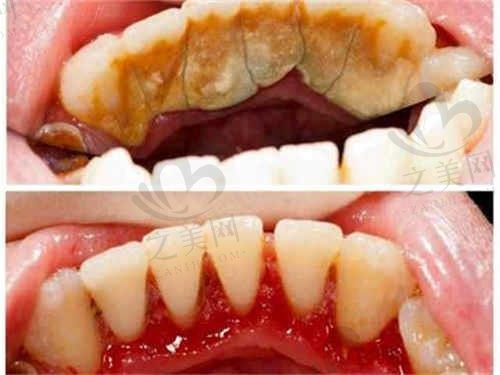 深圳壹方口腔牙周治疗怎么样?牙周病专职医生技术经验多吗?