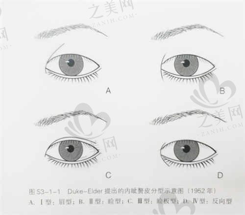 北京丽合医疗美容医院薛轶群医生双眼皮手术价格揭秘
