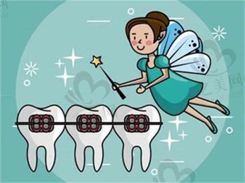 上海摩尔星松口腔正畸那么便宜?含牙套+调整仅需9900元起!正畸牙齿