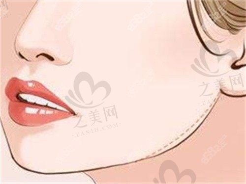 重庆松山医院磨骨朱乐林医生擅长颌面整形,韩系风格自然又上镜