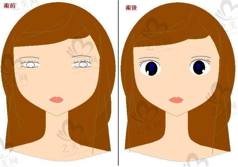 深圳艺星整形医院口碑怎么样?口碑评价+整形项目价格表