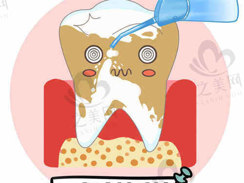 上海科瓦口腔洗牙项目详解