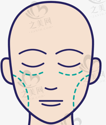 西安耳部整形医院口碑好的有哪些?排名前五耳部整形技术好推荐