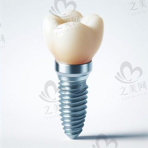 杭州牙医森口腔种植牙+烤瓷牙仅1.1万起，套餐多种组合任君选择