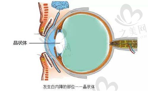 揭晓哈尔滨爱尔眼科医院电话