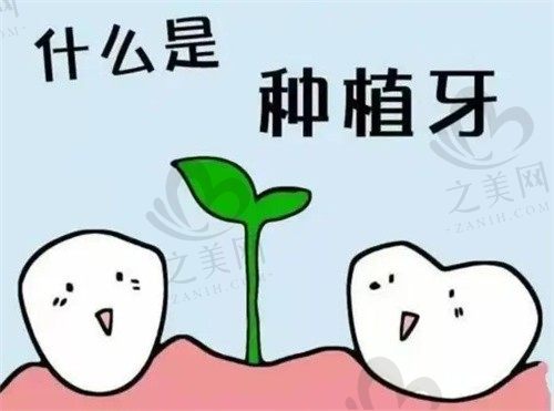 牙齿种植手术多少钱?成都华美牙科价目表一览