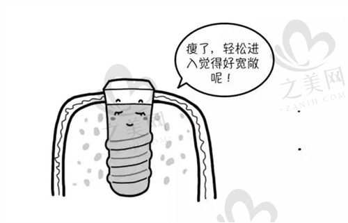 三甲医院和私立医院有何区别,选成都锦江极光口腔种植牙的优势