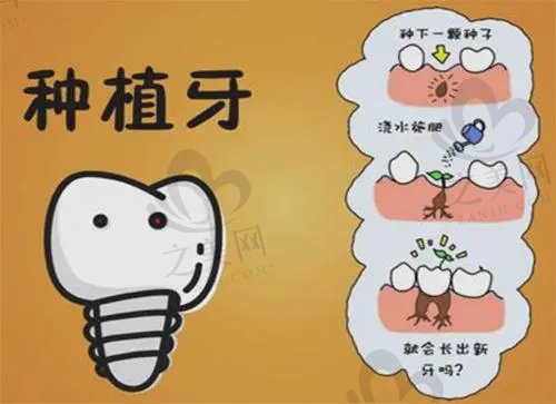 上海尤旦口腔提供种植牙、烤瓷牙等多个项目价格表