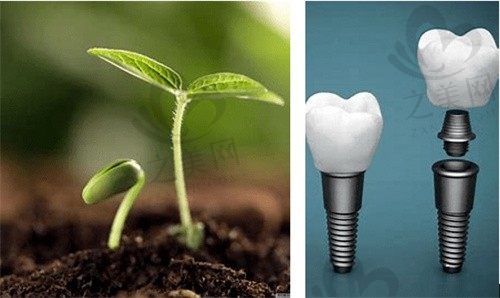 上海尤旦口腔提供种植牙、烤瓷牙等多个项目价格表让您第一时间了解