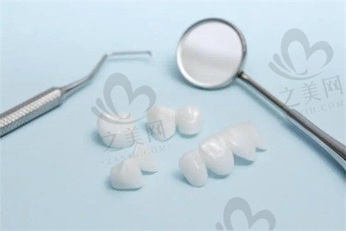 深圳爱康健口腔医院引进德国卡瓦数码美学全瓷牙技术,打造自然美丽的笑容