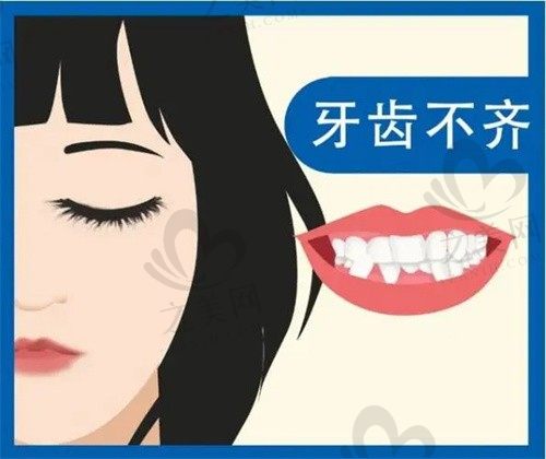 合肥松丰口腔正畸矫正方法有哪些?根据病情制定个性化治疗方案