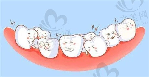 达州绮云口腔骨性反颌矫正怎么样?手术和非手术矫正方案怎么选?