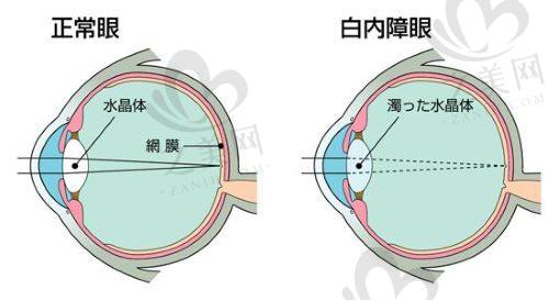 北京熙仁眼科医院