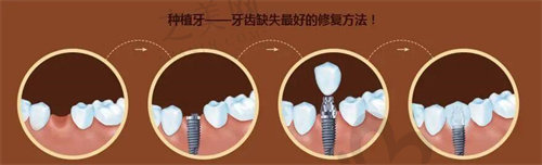 南昌品众口腔门诊部汪文文医生值得信赖