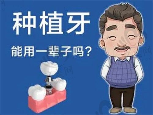 种牙”后多久可以吃苹果?欧亚协合牙科回答种牙常见问题TOP10