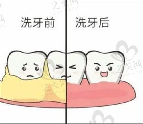 济南维乐口腔医院牙齿洁牙价格不贵,10步睡眠舒适洁牙仅需360元