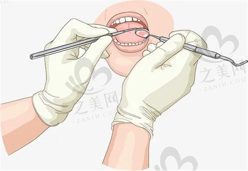 北京科尔口腔种植牙手术价格多少