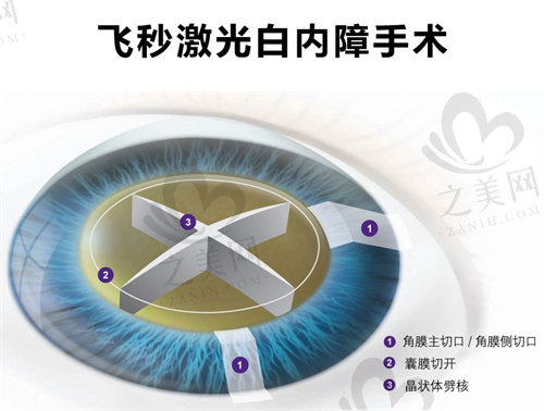 上海和平眼科医院项目价格一览表