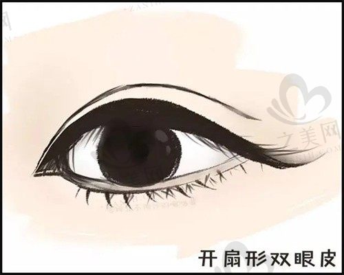 上海伊莱美割双眼皮手术怎么样?双眼皮成型效果好手法精细自然不易反弹