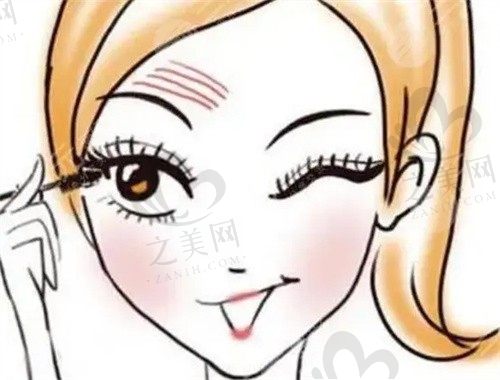 董娜医生双眼皮手术多少钱?消除眼袋、开眼角,重塑明眸动人