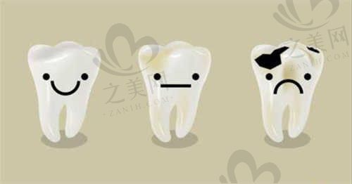 涿州倍悦家隐形矫正怎么样?张爽院长详解治疗方案