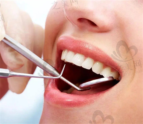 唐山牙博士口腔医院洗牙多少钱一次?
