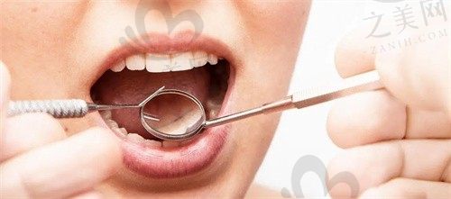 宁德博仕口腔怎么样?医院正规靠谱,口碑好又便宜