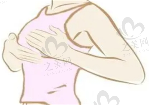 齐云香缩乳手术怎么样,采用无张力缝合手法术后还能正常哺乳哦