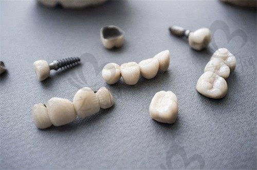 廊坊8020口腔医院种植牙怎么样?种植牙便宜又好,参考2024种植牙价格