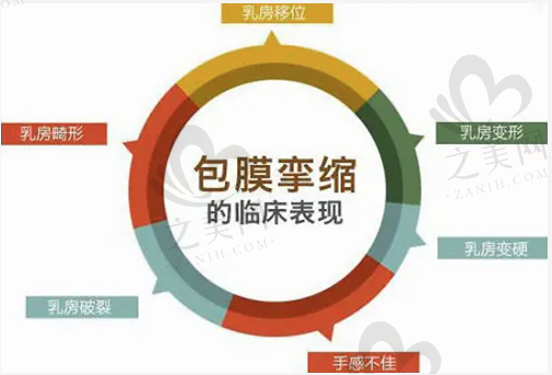 韩国普罗菲耳胸修复技术高超,内窥镜出血少假体取出视情况定