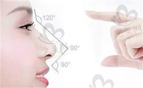 浙江台州艺星医疗美容口腔医院鼻部整形有哪些分类？
