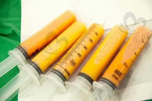 韩国365mc可以吸脂修复吗?当然可以且有超强的吸脂修复技术
