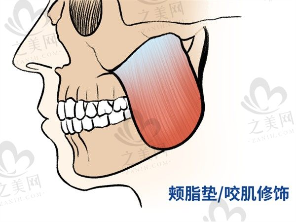 南京吴国平下颌角手术怎么样?整形技术出众术后成效自然柔和