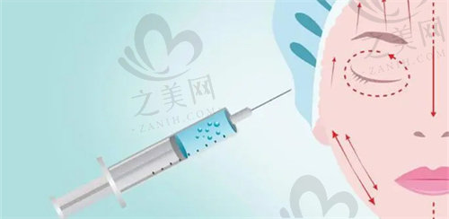 上海华美整形医院注射玻尿酸价格是多少？