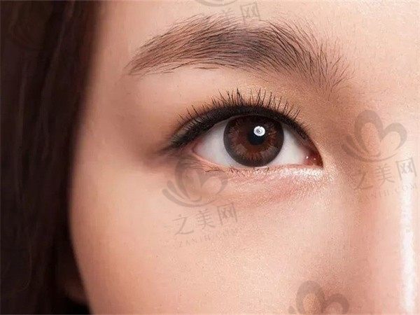 广州做双眼皮不错的医生推荐:陈贵宗、曾繁茂等医生技术都超棒