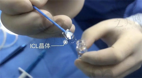 杭州柠盟眼科医院晶体植入手术价格