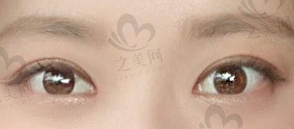 北京高难度眼修复专家揭晓排名前几名单及坐诊医院信息揭晓,内附眼修复价格表