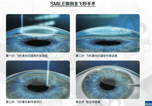北京眼科医院手术图
