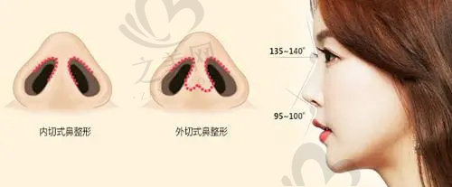 2024重庆军美医疗美容医院鼻整形价格表