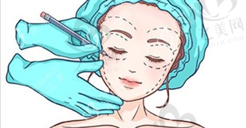 深圳富华整形救了我这双牛眼,眼部整形后大眼效果明显