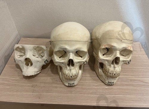 韩国伊美芝做轮廓怎么样?金成南做下颌角磨骨整形技术好口碑佳