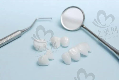 寶雞小白兔口腔全瓷牙冠價(jià)格 寶雞小白兔口腔全瓷牙冠價(jià)格