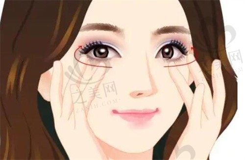 伊美芝整形外科做眼部整形怎么样?金镇亨院长双眼皮自然漂亮