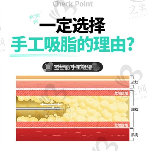 韩国宝士丽整形手工吸脂,金基范/李海俊操刀脂肪量纯出血少!
