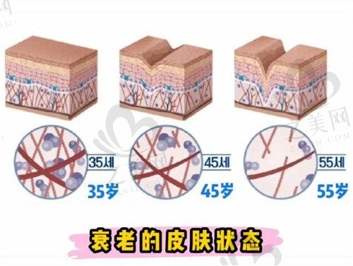 韩国宝士丽皮肤科热门项目大揭秘,金基范V脸提升针/玻尿酸填充价格美丽!