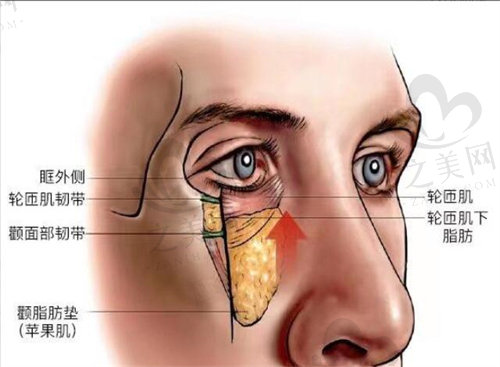韩国大眼睛整形外科下眼睑剥离