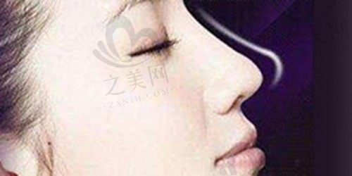 韩国鼻子做的较好院长推荐魏亨坤,坐诊韩国WILL 可量身定制鼻型