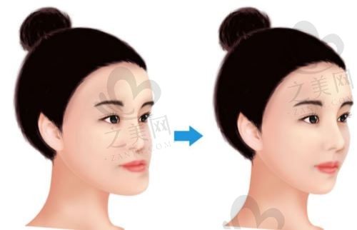想要有漂亮瓜子脸的姐妹们快看过来!韩国爱宝让你梦想成真