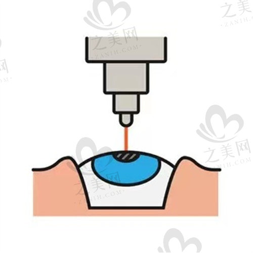 深圳新视代眼科优势.jpg