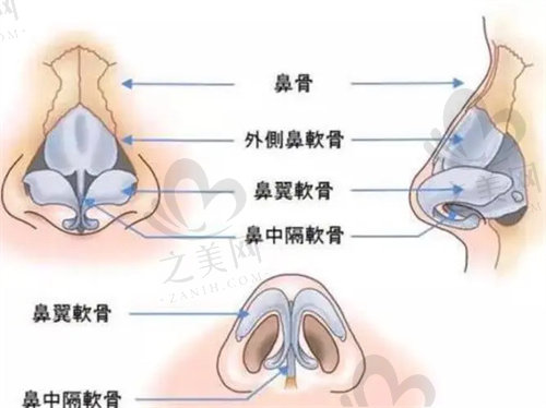 中山爱汇星医疗美容隆鼻价格